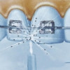 Irygator dentystyczny-1803853